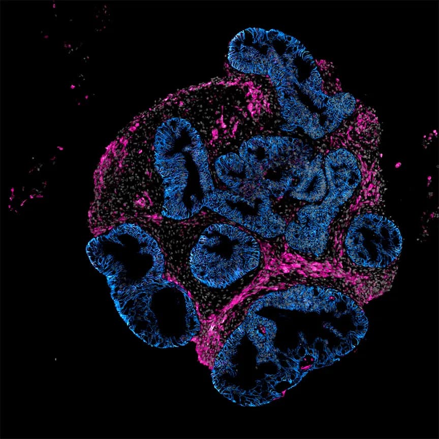 Intero Biosystems offers pharma companies to test drugs on mini-guts instead of animals
