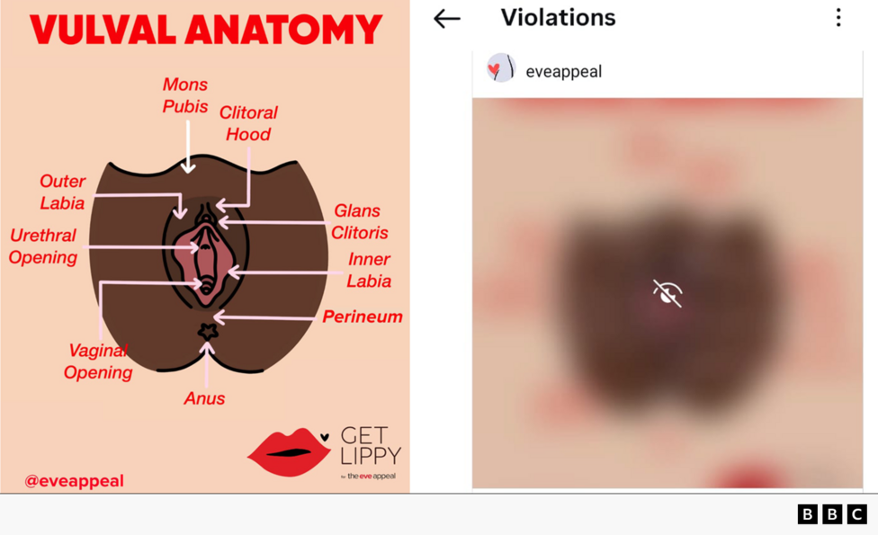 Screenshot comparing a labeled educational diagram of vulval anatomy with a blurred social media image. The left side shows a medical-style illustration titled “Vulval Anatomy,” labeling structures including the mons pubis, clitoral hood, glans clitoris, inner and outer labia, urethral opening, vaginal opening, perineum, and anus. The right side shows the same image heavily blurred and marked with an eye-with-slash icon on a social media platform’s “Violations” screen, indicating the content was restricted or hidden. A BBC logo appears in the bottom-right corner.