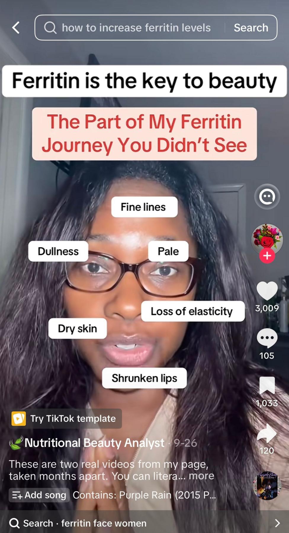 Screenshot of a TikTok video showing a woman speaking to camera. Text across the video reads “Ferritin is the key to beauty” and “The Part of My Ferritin Journey You Didn’t See”. Labels around her face point to claimed signs including “fine lines”, “dullness”, “pale”, “dry skin”, “loss of elasticity” and “shrunken lips”.