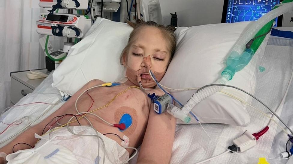 Willow lies on a hospital bed with tubes attached to her body