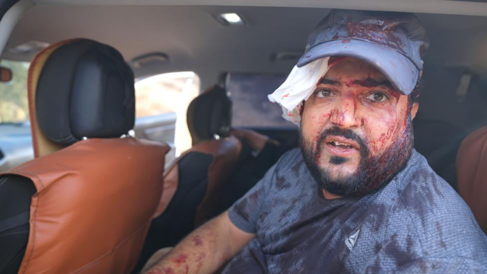 Yaser AlKam sits in the car with blood over his head and body