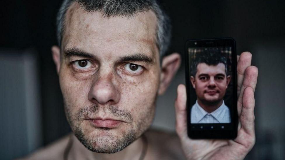 Ihor Shyshko looks directly into the camera. He is holding up photos of himself pre-imprisonment in Russia to draw a contrast between his appearance then and now. He now looks older, thinner and has sustained some scars. His hair has turned grey.